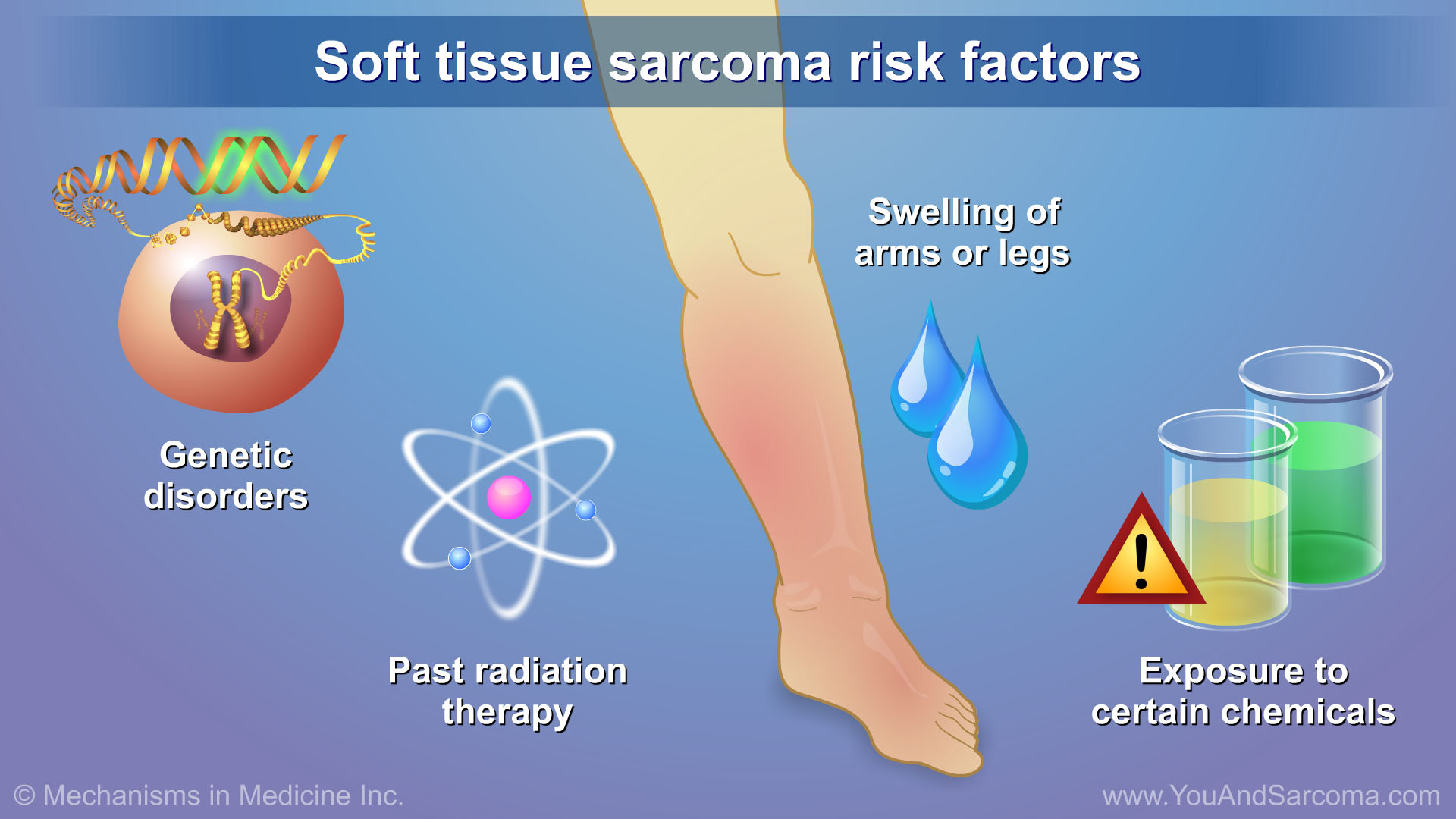 Diagnosing And Treating Soft Tissue Sarcoma