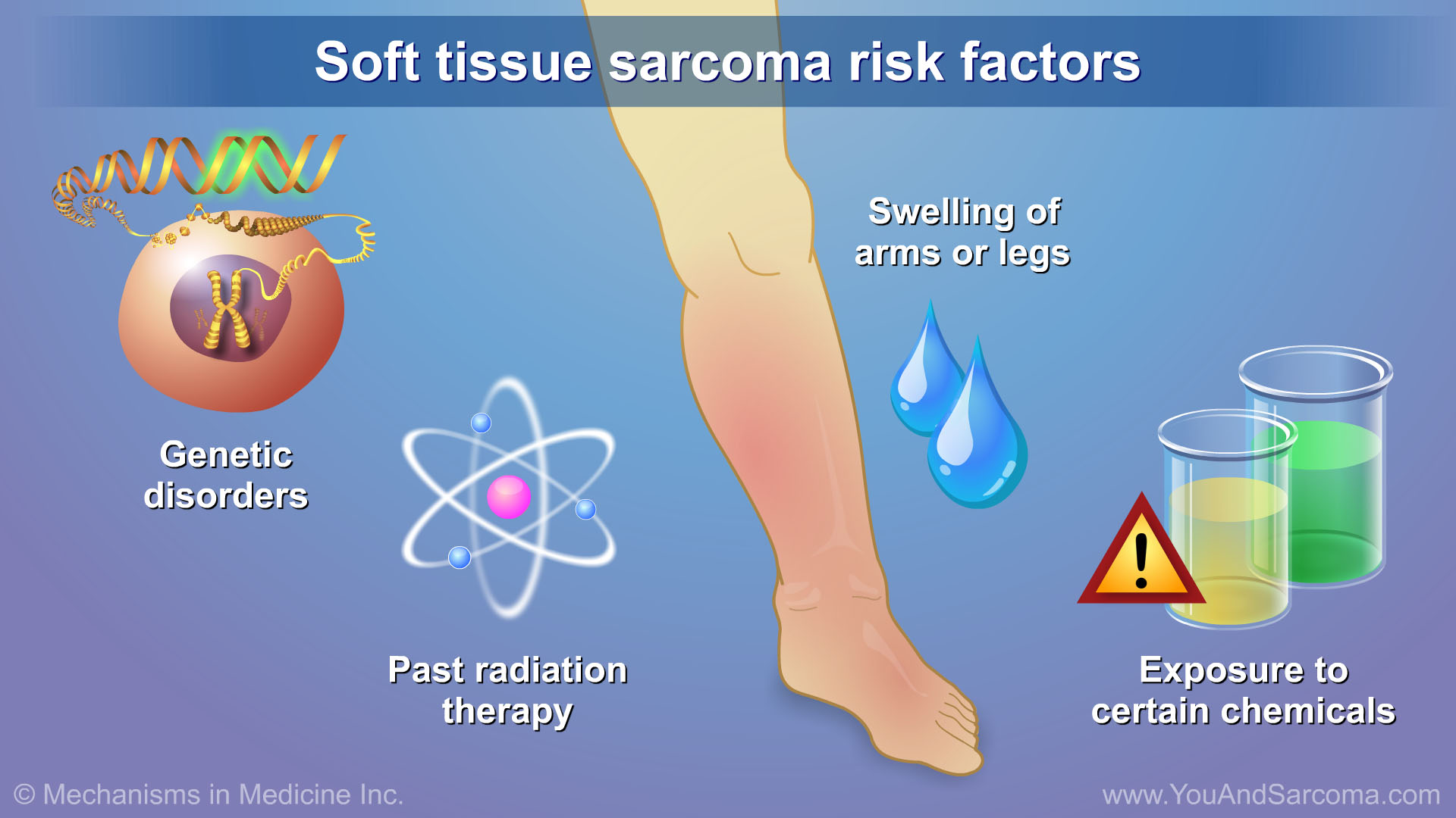 diagnosing-and-treating-soft-tissue-sarcoma